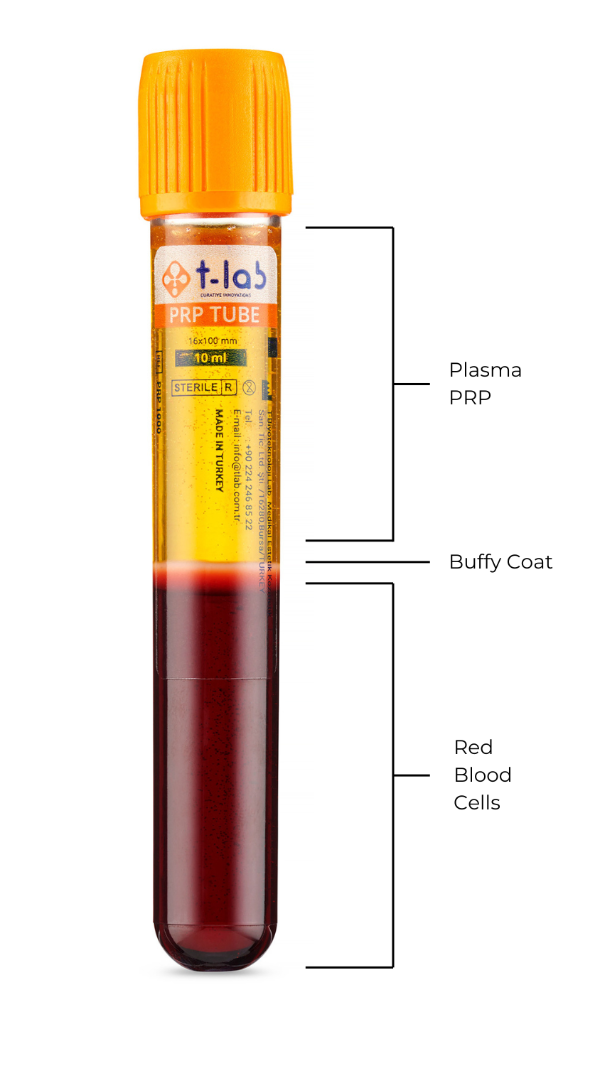 t-lab prp tube hawksley